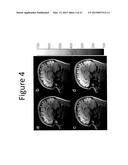 METHODS AND DEVICES FOR OPTIMIZATION OF MAGNETIC RESONANCE IMAGING     PROTOCOLS diagram and image