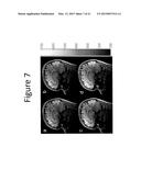 METHODS AND DEVICES FOR OPTIMIZATION OF MAGNETIC RESONANCE IMAGING     PROTOCOLS diagram and image