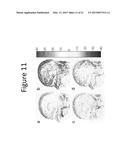 METHODS AND DEVICES FOR OPTIMIZATION OF MAGNETIC RESONANCE IMAGING     PROTOCOLS diagram and image