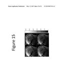 METHODS AND DEVICES FOR OPTIMIZATION OF MAGNETIC RESONANCE IMAGING     PROTOCOLS diagram and image