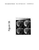 METHODS AND DEVICES FOR OPTIMIZATION OF MAGNETIC RESONANCE IMAGING     PROTOCOLS diagram and image