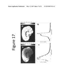 METHODS AND DEVICES FOR OPTIMIZATION OF MAGNETIC RESONANCE IMAGING     PROTOCOLS diagram and image