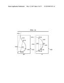 Spiculated Malignant Mass Detection and Classification in a Radiographic     Image diagram and image