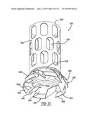 AXIAL FLOW ATOMIZATION MODULE WITH MIXING DEVICE diagram and image