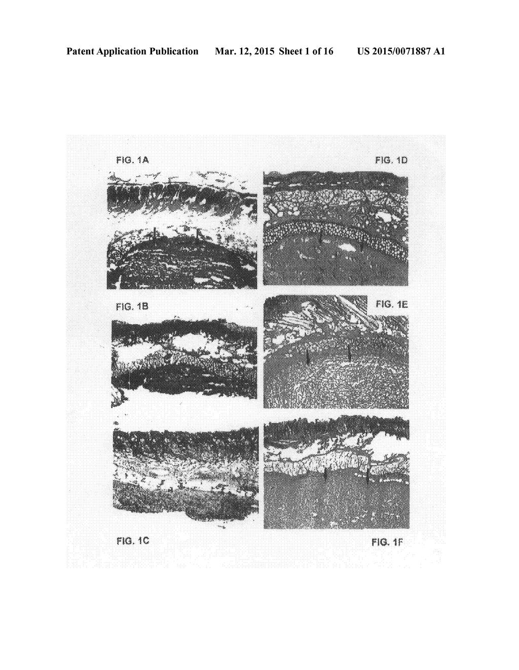 Soft Tissue and Bone Augmentation and Bulking Utilizing Muscle-Derived     Progenitor Cells, Compositions and Treatments Thereof - diagram, schematic, and image 02