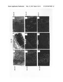 Soft Tissue and Bone Augmentation and Bulking Utilizing Muscle-Derived     Progenitor Cells, Compositions and Treatments Thereof diagram and image