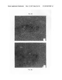 Soft Tissue and Bone Augmentation and Bulking Utilizing Muscle-Derived     Progenitor Cells, Compositions and Treatments Thereof diagram and image