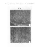 Soft Tissue and Bone Augmentation and Bulking Utilizing Muscle-Derived     Progenitor Cells, Compositions and Treatments Thereof diagram and image