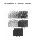 Soft Tissue and Bone Augmentation and Bulking Utilizing Muscle-Derived     Progenitor Cells, Compositions and Treatments Thereof diagram and image