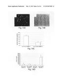 Soft Tissue and Bone Augmentation and Bulking Utilizing Muscle-Derived     Progenitor Cells, Compositions and Treatments Thereof diagram and image