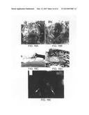 Soft Tissue and Bone Augmentation and Bulking Utilizing Muscle-Derived     Progenitor Cells, Compositions and Treatments Thereof diagram and image