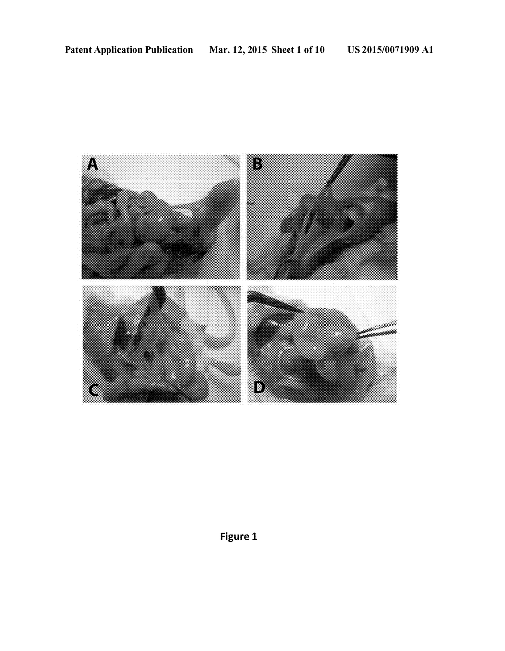 METHODS AND COMPOSITIONS FOR REDUCING THE INCIDENCE OF POST-SURGICAL     ADHESIONS - diagram, schematic, and image 02