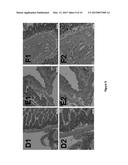 METHODS AND COMPOSITIONS FOR REDUCING THE INCIDENCE OF POST-SURGICAL     ADHESIONS diagram and image