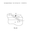 BATTERY MODULE LID SYSTEM AND METHOD diagram and image