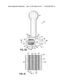 ORTHODONTIC APPLIANCES AND METHODS OF MAKING AND USING SAME diagram and image