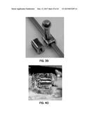 ORTHODONTIC APPLIANCES AND METHODS OF MAKING AND USING SAME diagram and image