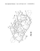 ORTHODONTIC APPLIANCES AND METHODS OF MAKING AND USING SAME diagram and image