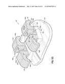 ORTHODONTIC APPLIANCES AND METHODS OF MAKING AND USING SAME diagram and image