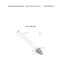 Dental Implant Cleaner diagram and image