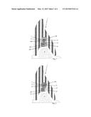 Precision attachment system with indirect retainer diagram and image