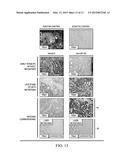 IDENTIFICATION OF METASTASIS-SPECIFIC MIRNA AND HYPOMETHYLATION SIGNATURES     IN HUMAN COLORECTAL CANCER diagram and image