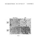 ANTIBODIES AND METHOD FOR DETERMINING DELETIONS IN HBV PRE-S2 REGION diagram and image