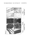 MATERIALS AND METHODS FOR SUPPRESSING AND/OR TREATING NEUROFIBROMA AND     RELATED TUMORS diagram and image