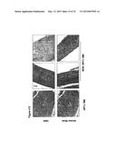 MATERIALS AND METHODS FOR SUPPRESSING AND/OR TREATING NEUROFIBROMA AND     RELATED TUMORS diagram and image