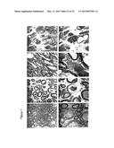 MATERIALS AND METHODS FOR SUPPRESSING AND/OR TREATING NEUROFIBROMA AND     RELATED TUMORS diagram and image