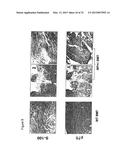 MATERIALS AND METHODS FOR SUPPRESSING AND/OR TREATING NEUROFIBROMA AND     RELATED TUMORS diagram and image