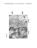 MATERIALS AND METHODS FOR SUPPRESSING AND/OR TREATING NEUROFIBROMA AND     RELATED TUMORS diagram and image