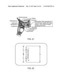 DEVICES AND METHODS FOR AIRFLOW DIAGNOSIS AND RESTORATION diagram and image