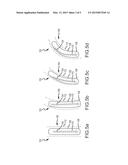 System and method for measuring force and torque applied to a catheter     electrode tip diagram and image