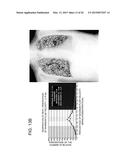 DYNAMIC DIAGNOSIS SUPPORT INFORMATION GENERATION SYSTEM diagram and image