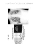 DYNAMIC DIAGNOSIS SUPPORT INFORMATION GENERATION SYSTEM diagram and image