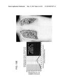 DYNAMIC DIAGNOSIS SUPPORT INFORMATION GENERATION SYSTEM diagram and image