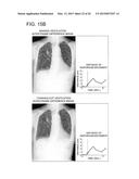 DYNAMIC DIAGNOSIS SUPPORT INFORMATION GENERATION SYSTEM diagram and image