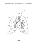 SYSTEM AND METHOD FOR LUNG VISUALIZATION USING ULTASOUND diagram and image