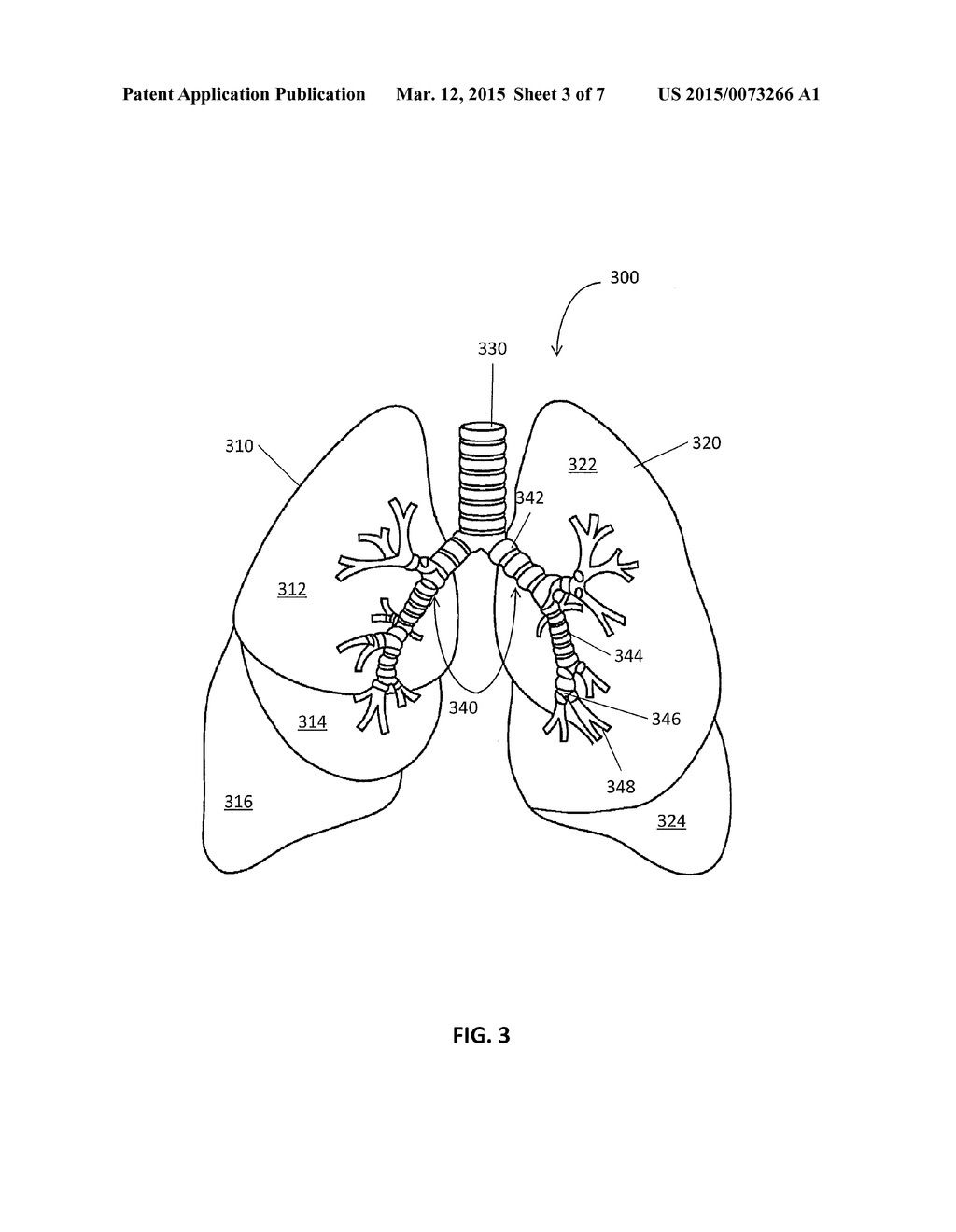 SYSTEM AND METHOD FOR LUNG VISUALIZATION USING ULTASOUND - diagram, schematic, and image 04