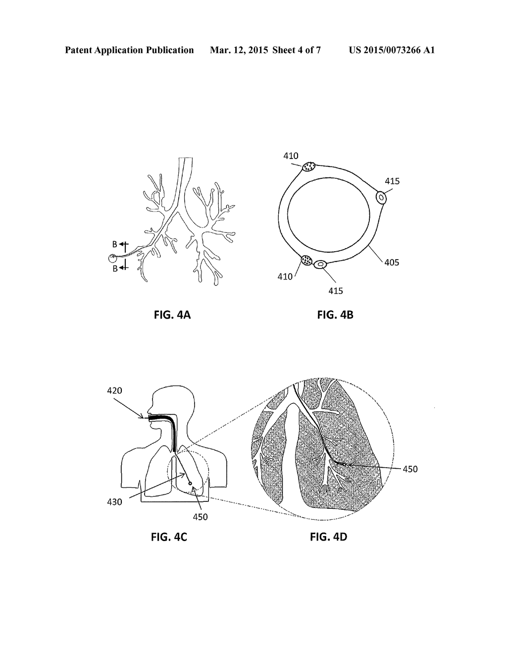 SYSTEM AND METHOD FOR LUNG VISUALIZATION USING ULTASOUND - diagram, schematic, and image 05