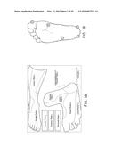 SYSTEMS AND METHODS FOR REVASCULARIZATION ASSESSMENT diagram and image