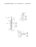 SYSTEMS AND METHODS FOR REVASCULARIZATION ASSESSMENT diagram and image