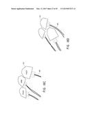 SYSTEMS AND METHODS FOR REVASCULARIZATION ASSESSMENT diagram and image