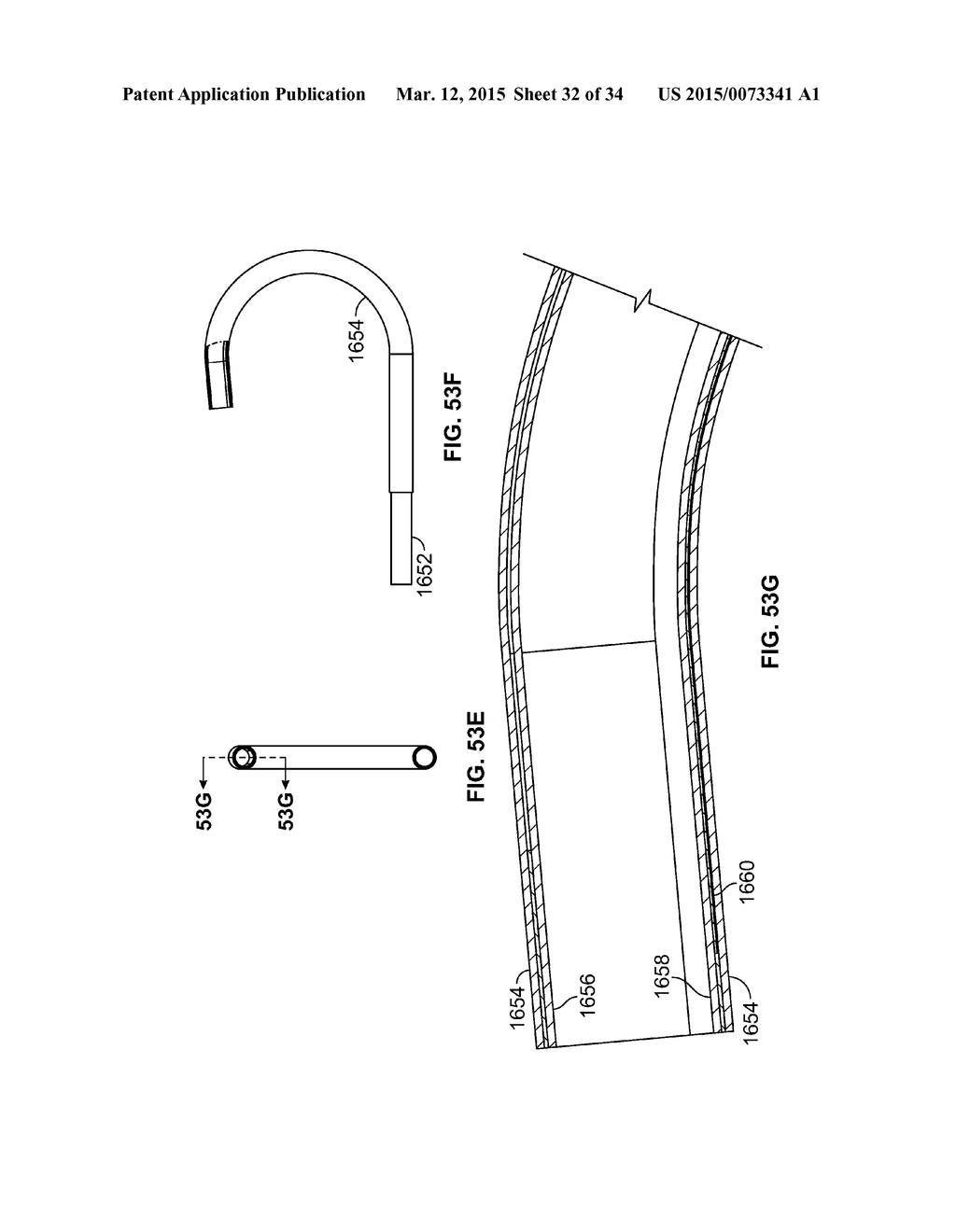 STEERABLE DELIVERY SHEATHS - diagram, schematic, and image 33