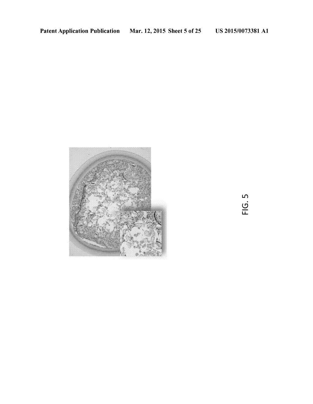 Encapsulated Cell Therapy Cartridge - diagram, schematic, and image 06