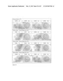 Encapsulated Cell Therapy Cartridge diagram and image