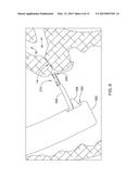 MEDICAL DEVICE WITH A MOVABLE TIP diagram and image