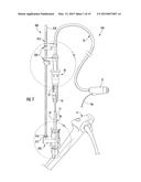 MICROWAVE ABLATION CATHETER, HANDLE, AND SYSTEM diagram and image