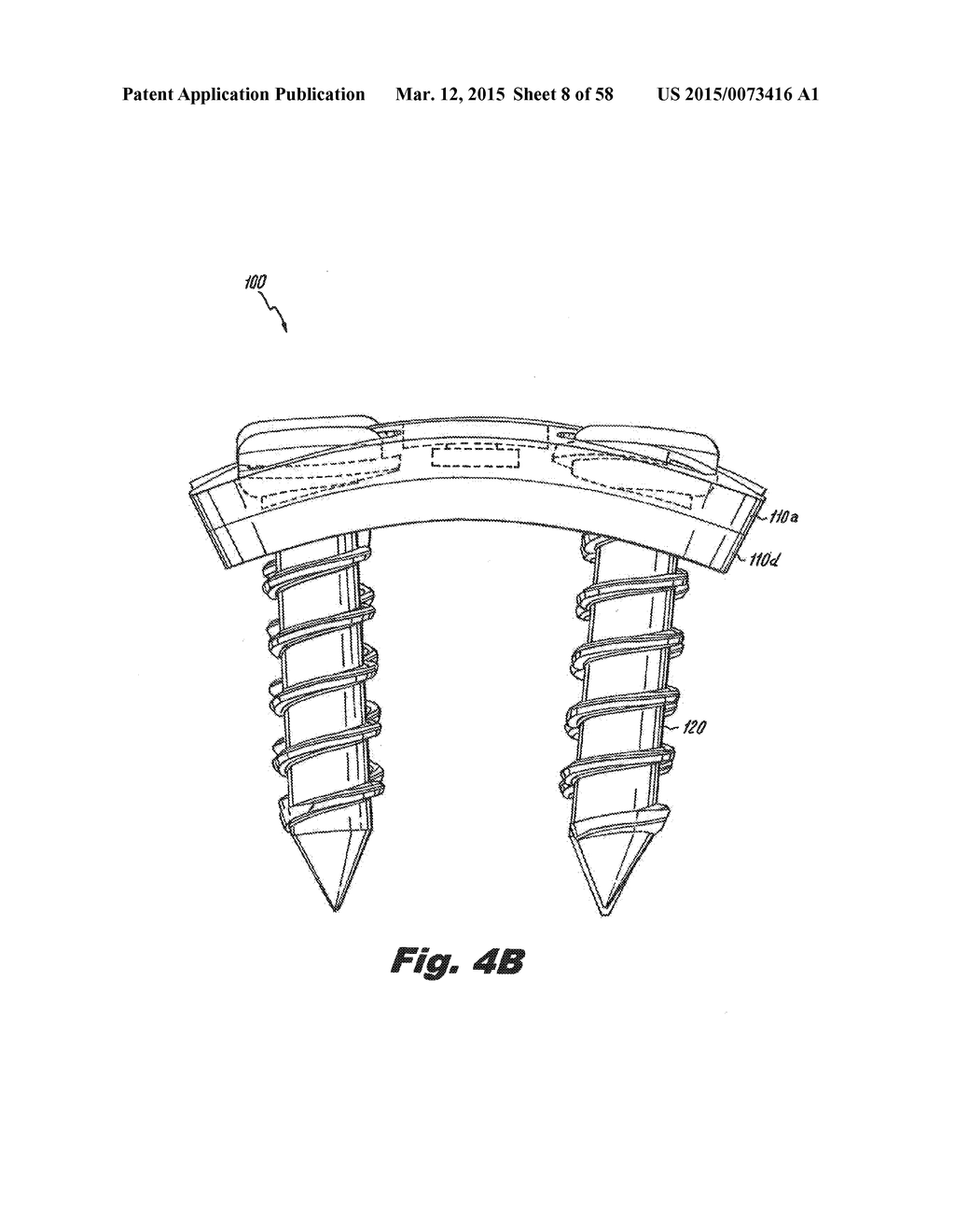 BONE PLATE ASSEMBLY WITH PLATES THAT RATCHET TOGETHER - diagram, schematic, and image 09