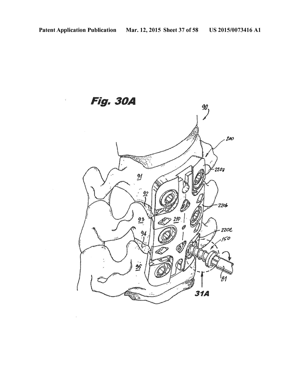 BONE PLATE ASSEMBLY WITH PLATES THAT RATCHET TOGETHER - diagram, schematic, and image 38